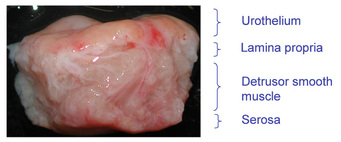Figure 1: Photography of a section from human bladder wall.