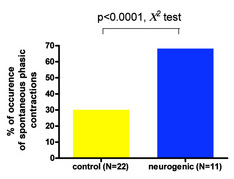 Figure 1: Occurrence and characterization of spontaneous phasic contractile activity in detrusor from neurogenic patients when compared to detrusor from control patients. Oger, S. et al. J Urol Abstract (AUA, 2008) : 179(4) : 352 