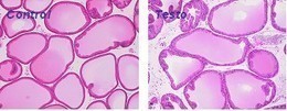 Figure 1: Representative microphotographs of rat prostatic lateral lobes stained with hematoxylin-eosin (HE) observed at x100 magnification in sesame oil (left panel) and testosterone (right panel)-treated rats (3 weeks, 3 mg/kg/d) (Pelvipharm, internal data).