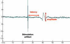 Figure 2: Example of PMRD recorded following bilateral electrical stimulation of DNP in anaesthetised rat (Pelvipharm, internal data).