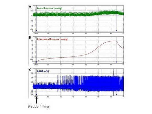 Figure 2: Representative blood pressure (A) and cystometrogram tracings (B) and its concomitant recording of bladder afferent nerve firing (C) in a decerebrate unanesthetized normal rat.